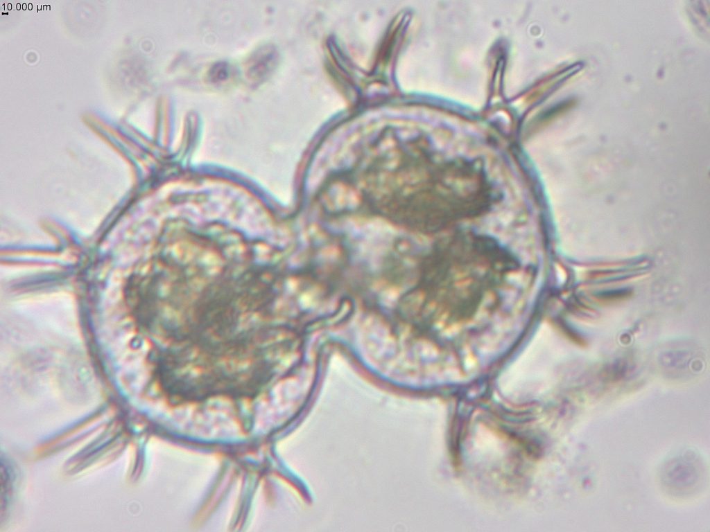 Com apoio do Governo do Amazonas, pesquisa identifica duzentas espécies de microalgas em Parintins 4 Fapeam Pesquisa identifica duzentas especies de microalgas em Parintins Foto arquivo da pesquisadora Angela Maria da Silva Lehmkuhl 3