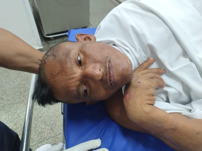 Hospital João Lúcio pede ajuda para localizar familiares de usuário que encontra-se internado, sem identificação