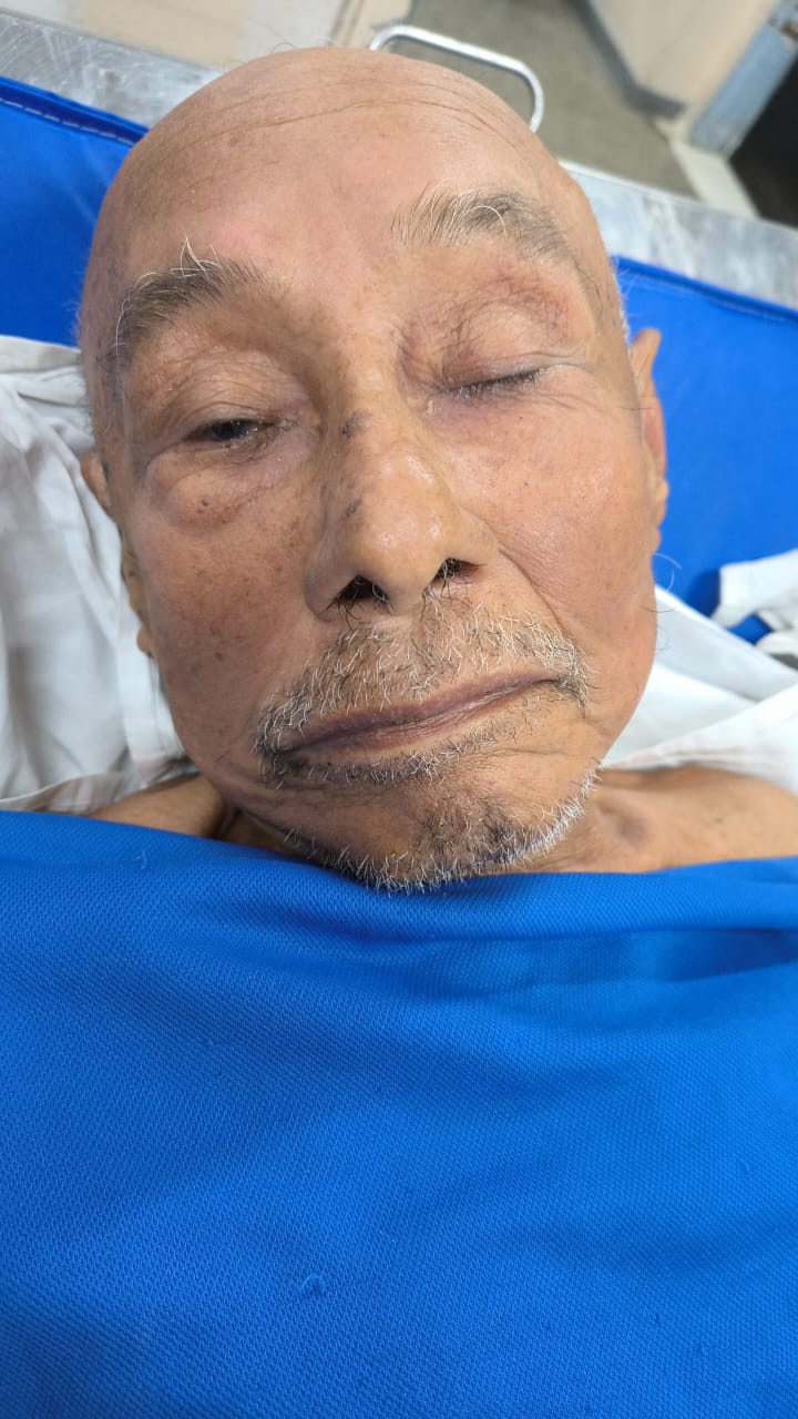 HPS João Lúcio pede ajuda para localizar familiares do paciente Fábio Pinheiro, de 75 anos